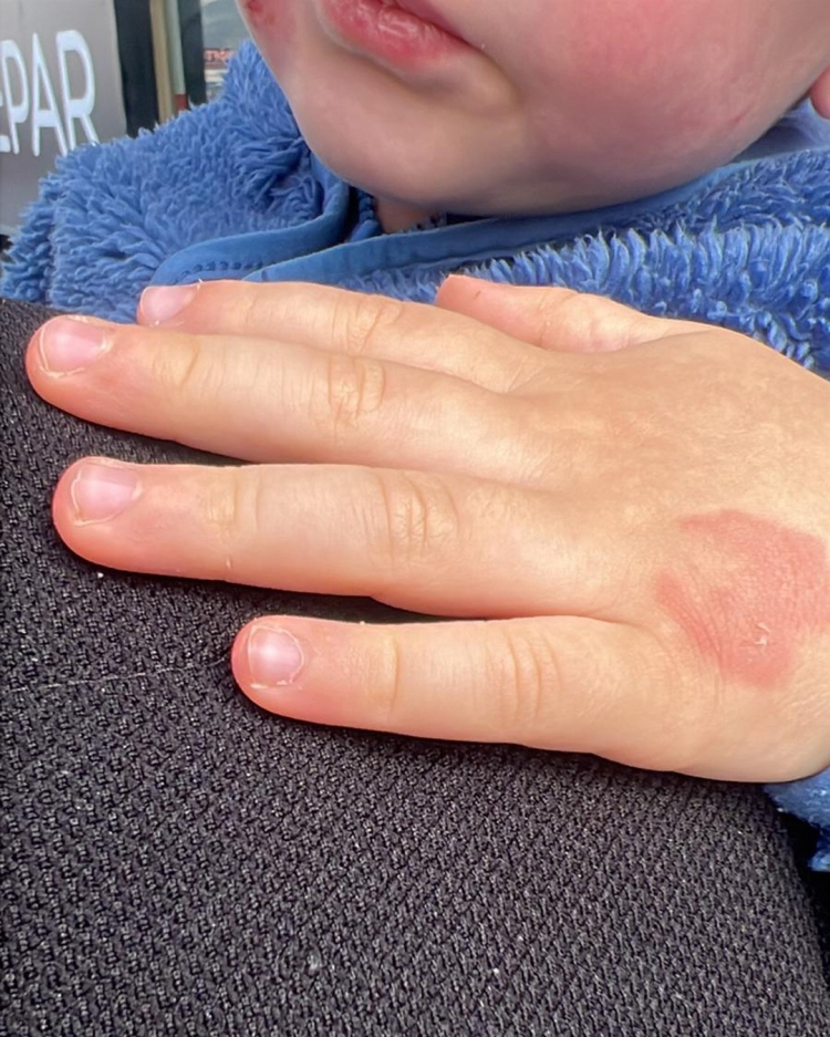 Bursa’da kreşte şiddet ve ihmal iddiası: Aile savcılığa başvurdu - Bursa Hayat Gazetesi-2