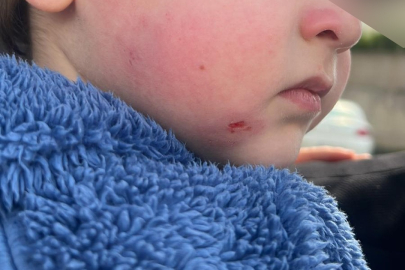 Bursa’da kreşte şiddet ve ihmal iddiası: Aile savcılığa başvurdu