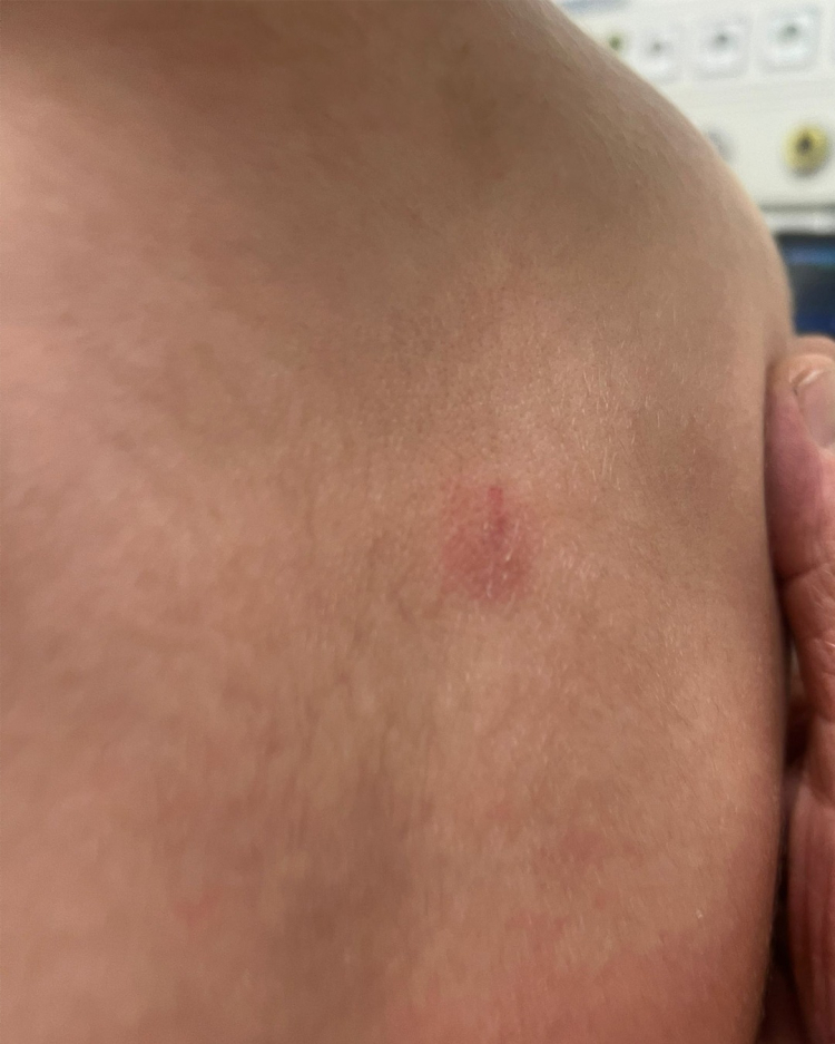 Bursa’da kreşte şiddet ve ihmal iddiası: Aile savcılığa başvurdu - Bursa Hayat Gazetesi-4