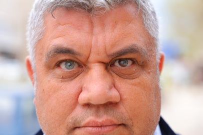 Doğuştan gelen farklılık! Bir gözü mavi diğeri çok renkli…