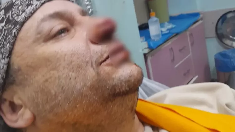 Köpek saldırısı sonrası Onur Akay entübe edildi!-Bursa Hayat-2