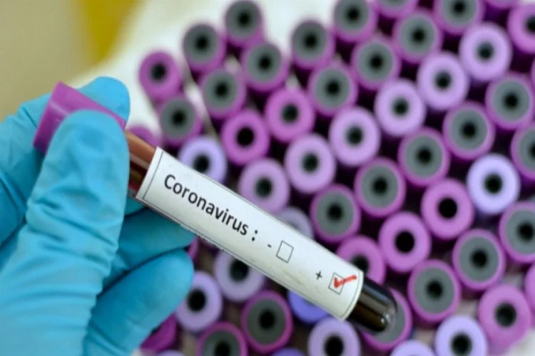 'Bakan'dan yeni açıklama! Virüsten can kaybı 108 oldu