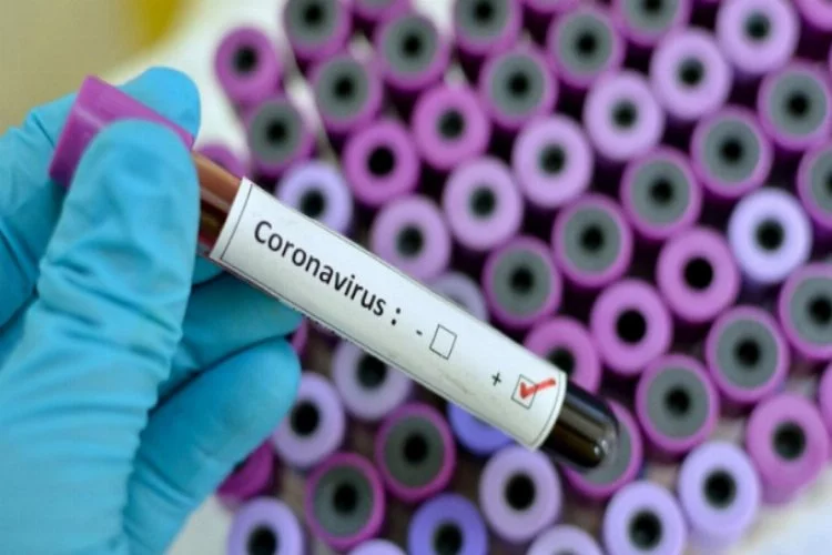 Meclis doktorunun koronavirüs test sonucu belli oldu!