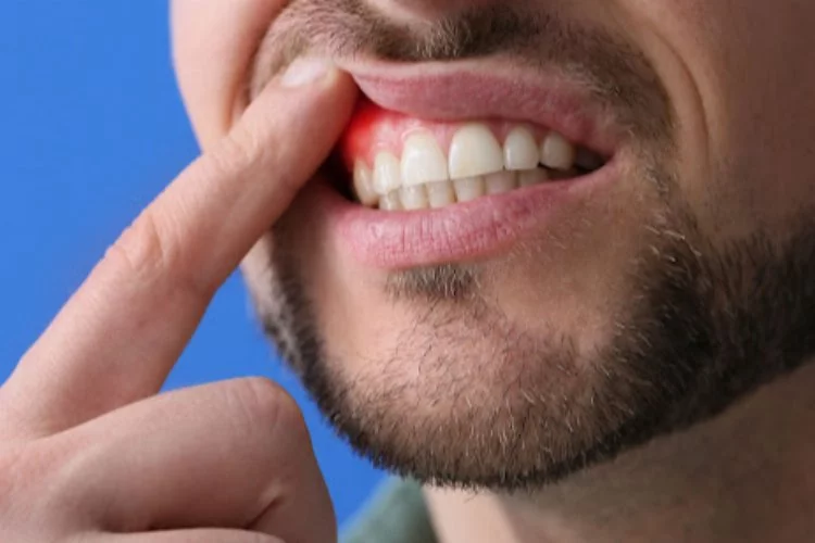 Ağız ve diş sağlığı: Dişlerinizi korumanın ve diş eti hastalıklarından kaçınmanın önemi