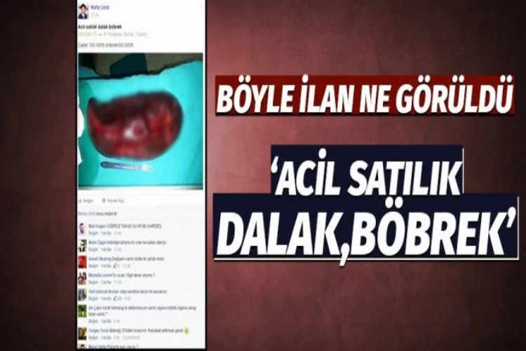 Bursa'da bir garip ilan: Acil dalak böbrek satılır!