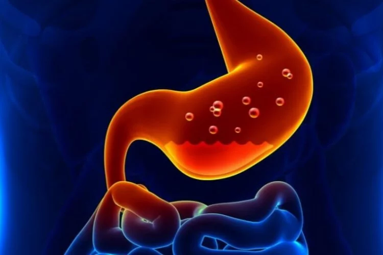 Gastroözofageal Reflü hastalığı (GERD): Belirtiler, nedenler ve tedavi seçenekleri